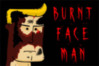 Burnt Face Man
