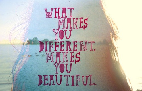 What makes you different, makes you beautiful.