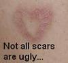 Not All Scars Are Ugly