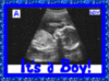 Sonogram- It's a Boy!